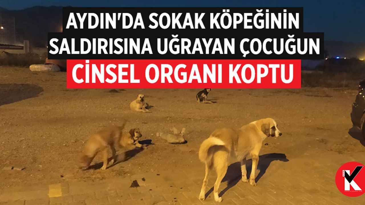 Aydın'da sokak köpeğinin saldırısına uğrayan çocuğun cinsel organı koptu