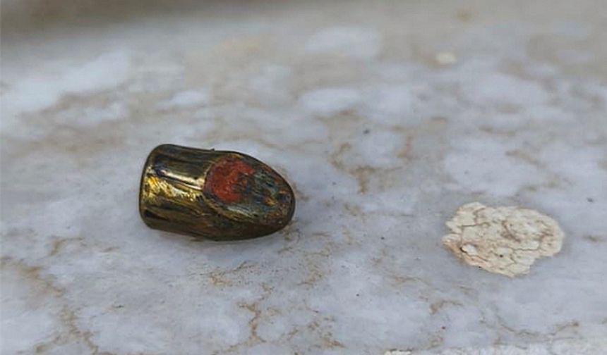 Yemek yerken bacağına yorgun mermi isabet etti