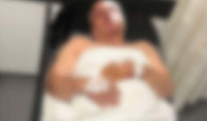 Ehliyetsiz sürücü, kardeşine ciple çarptı