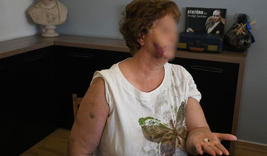 Kuşadası'nda ev kavgası kanlı bitti